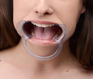 Медицинский стоматологический расширитель для рта
